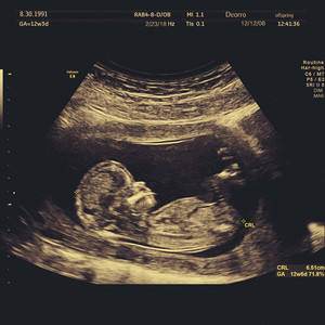 大雷擦狙狙网站17c
